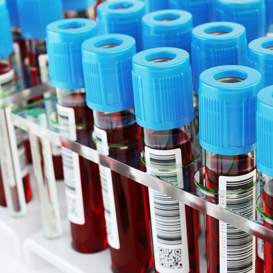 Blood test tubes. Blood samples in a rack. 3d illustration