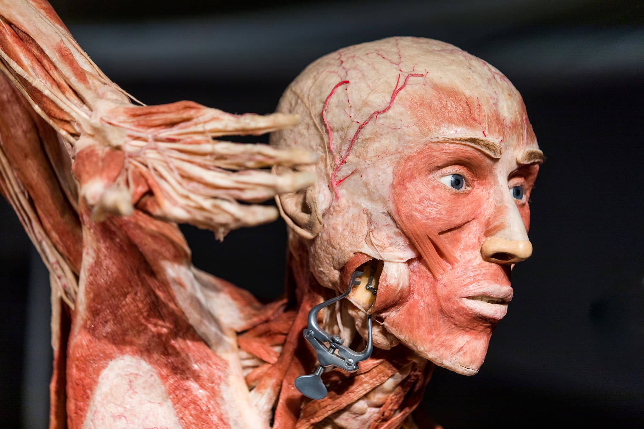 Body Worlds